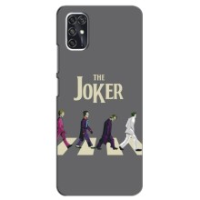 Чехлы с картинкой Джокера на ZTE V2020 Smart – The Joker