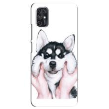 Чехол с Хаски для ZTE V2020 Smart - (AlphaPrint) (Хаски улыбака)