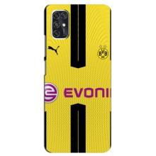 Чохоли з ТОР футбольними клубами на ZTE V2020 Smart (BVB)