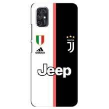Чохоли з ТОР футбольними клубами на ZTE V2020 Smart (Juventus)