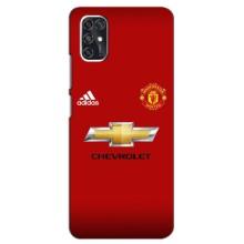 Силіконові Чохли з принтом Футбол на ZTE V2020 Smart (Man United)