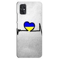 Силиконовый Чехол на ZTE V2020 Smart (Я-Украина) (Украинская кардиограмма)