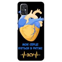 ЗСУ Чохли (TPU) для ZTE V2020 Smart (Ритм ЗСУ)