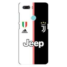 Чехлы для ZTE Z18 Mini (VPrint) - Футбольные клубы (Juventus)